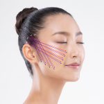 糸リフトシェーマ
