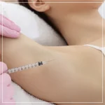 thumbnail__armpit-botox