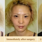 img_comparison_progression–en