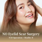 recomended__no-eyelid-scar-surgery