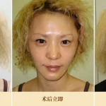 img_comparison_progression–zh