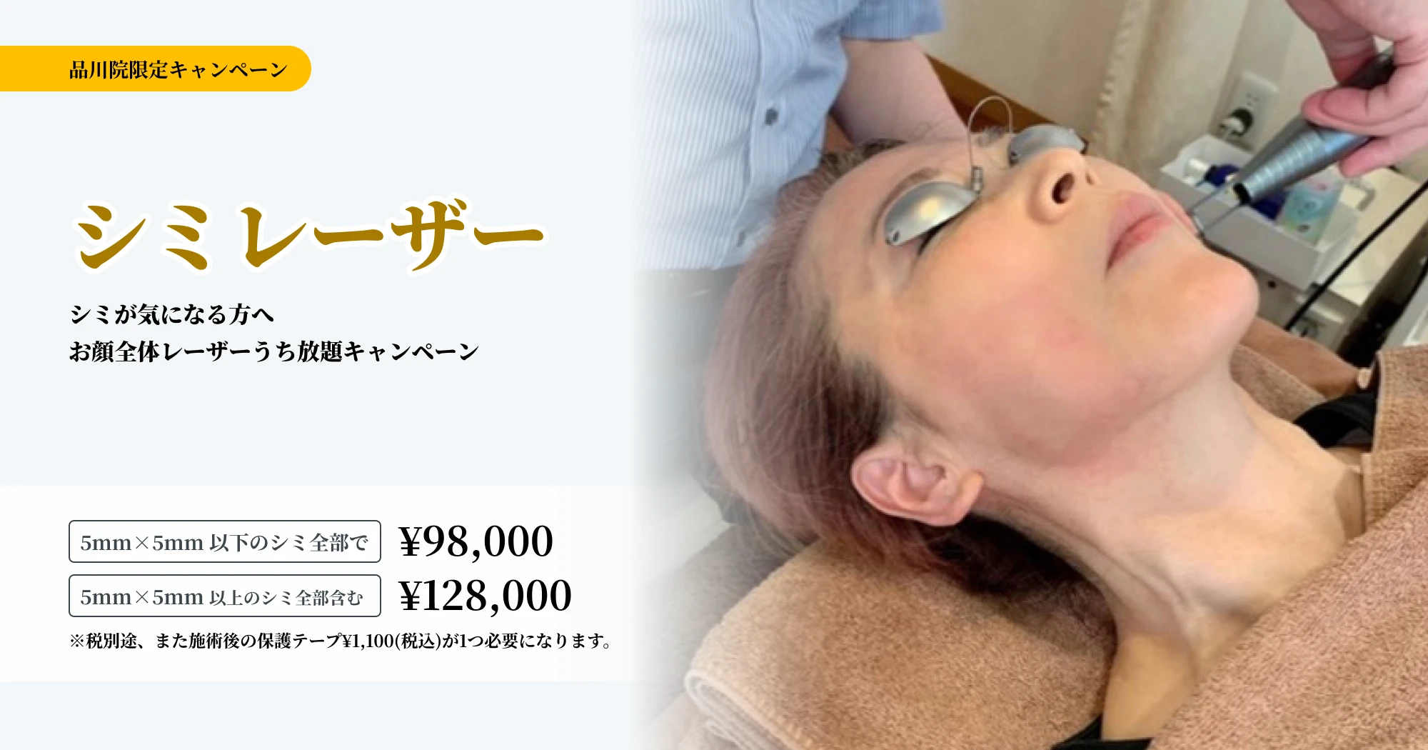 シミレーザー シミレーザー