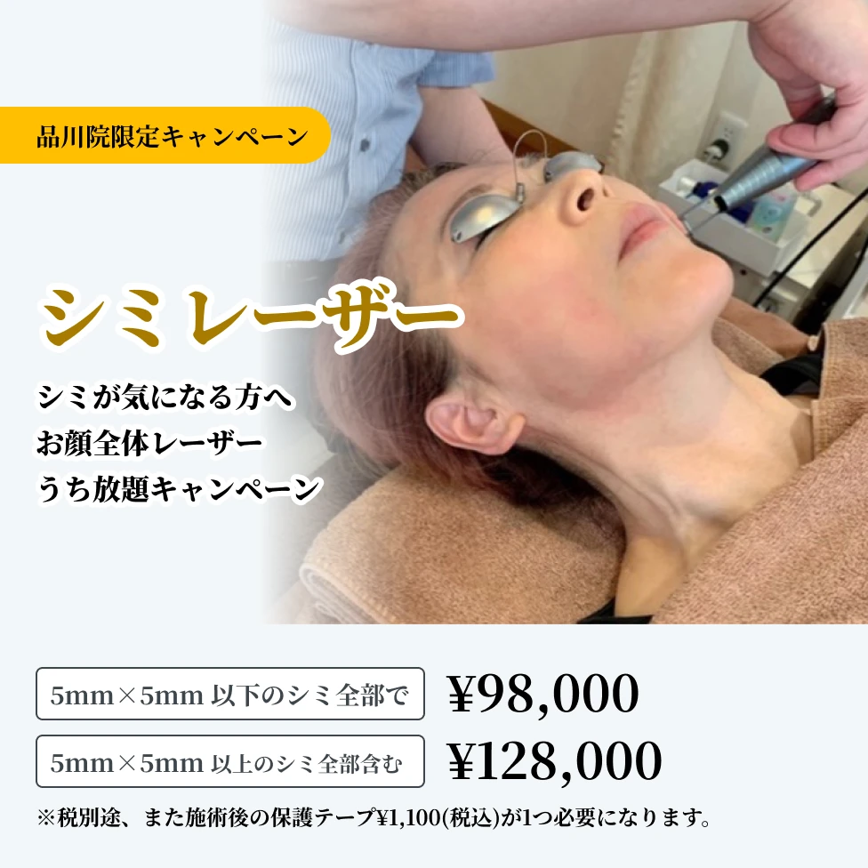 シミレーザー シミレーザー