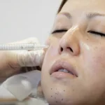 img__beauty-note-skin-rejuvenation-01